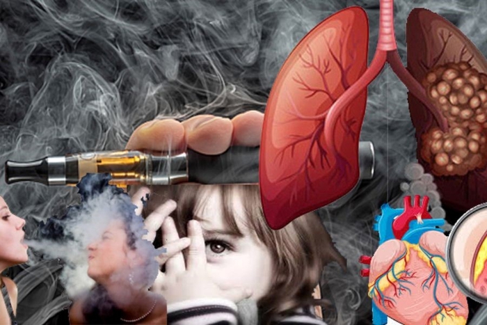 5 tuyên bố về thuốc lá gây hiểu lầm và sự thật- Ảnh 2. 5 tuyên bố về thuốc lá gây hiểu lầm và sự thật- Ảnh 2.