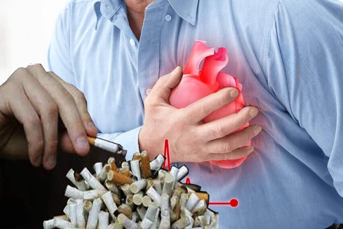 Tăng thuế thuốc lá giúp bảo vệ sức khỏe cộng đồng, giảm gánh nặng bệnh tật và tử vong- Ảnh 3. Tăng thuế thuốc lá giúp bảo vệ sức khỏe cộng đồng, giảm gánh nặng bệnh tật và tử vong- Ảnh 3.