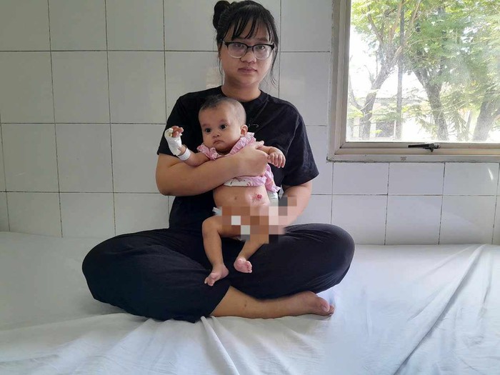 Ánh mắt cầu cứu của bé gái 6 tháng tuổi bị dị tật bẩm sinh, không tiền cứu chữa- Ảnh 5. Ánh mắt cầu cứu của bé gái 6 tháng tuổi bị dị tật bẩm sinh, không tiền cứu chữa- Ảnh 5.