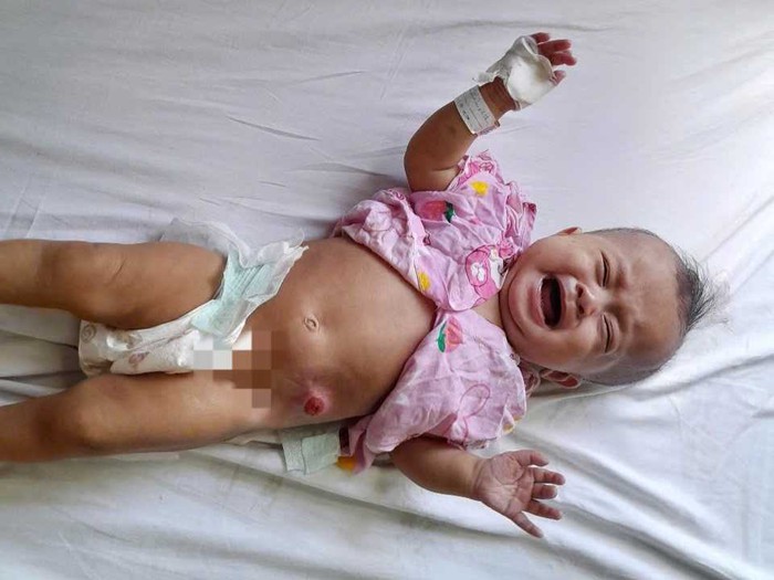 Ánh mắt cầu cứu của bé gái 6 tháng tuổi bị dị tật bẩm sinh, không tiền cứu chữa- Ảnh 4. Ánh mắt cầu cứu của bé gái 6 tháng tuổi bị dị tật bẩm sinh, không tiền cứu chữa- Ảnh 4.