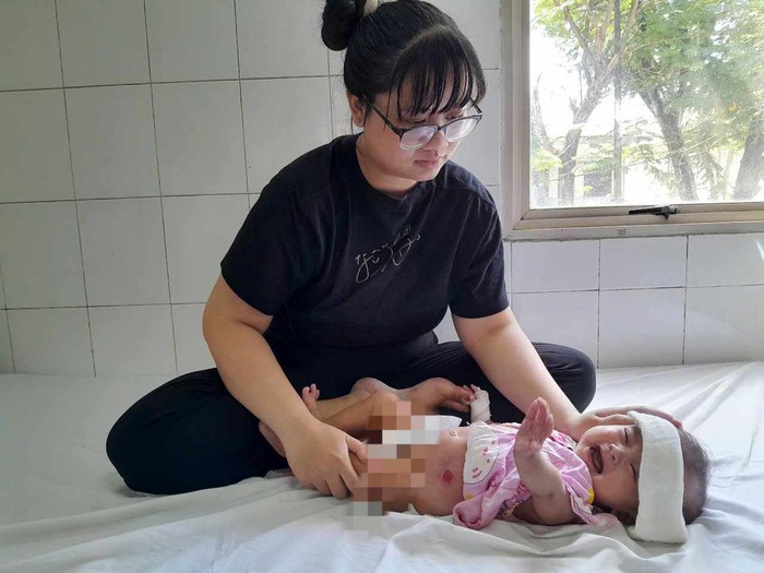 Ánh mắt cầu cứu của bé gái 6 tháng tuổi bị dị tật bẩm sinh, không tiền cứu chữa- Ảnh 1. Ánh mắt cầu cứu của bé gái 6 tháng tuổi bị dị tật bẩm sinh, không tiền cứu chữa- Ảnh 1.