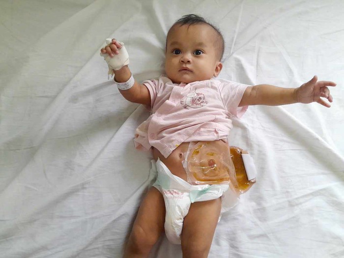 Ánh mắt cầu cứu của bé gái 6 tháng tuổi bị dị tật bẩm sinh, không tiền cứu chữa- Ảnh 2. Ánh mắt cầu cứu của bé gái 6 tháng tuổi bị dị tật bẩm sinh, không tiền cứu chữa- Ảnh 2.