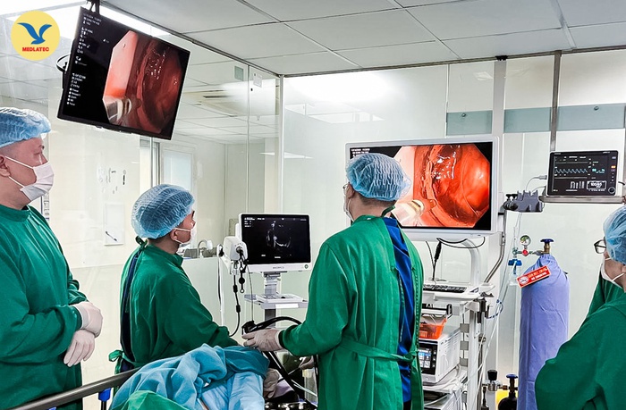 Nội soi siêu âm (EUS): Giải pháp hiện đại trong phát hiện và điều trị bệnh tiêu hóa- Ảnh 3. Nội soi siêu âm (EUS): Giải pháp hiện đại trong phát hiện và điều trị bệnh tiêu hóa- Ảnh 3.