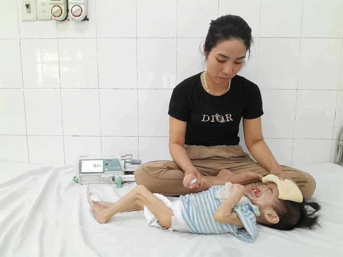 Bé gái 3 tuổi có khuôn mặt biến dạng vì dị tật mong chờ cơ hội được phẫu thuật- Ảnh 3. Bé gái 3 tuổi có khuôn mặt biến dạng vì dị tật mong chờ cơ hội được phẫu thuật- Ảnh 3.