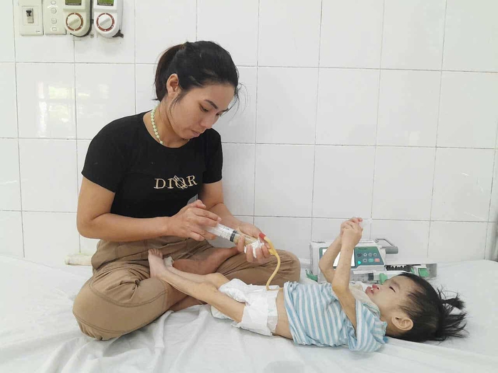 Bé gái 3 tuổi có khuôn mặt biến dạng vì dị tật mong chờ cơ hội được phẫu thuật- Ảnh 1. Bé gái 3 tuổi có khuôn mặt biến dạng vì dị tật mong chờ cơ hội được phẫu thuật- Ảnh 1.