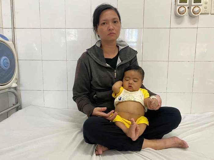 Ánh mắt cầu cứu của bé trai 7 tháng tuổi bụng to bất thường vì bệnh hiểm nghèo- Ảnh 3. Ánh mắt cầu cứu của bé trai 7 tháng tuổi bụng to bất thường vì bệnh hiểm nghèo- Ảnh 3.