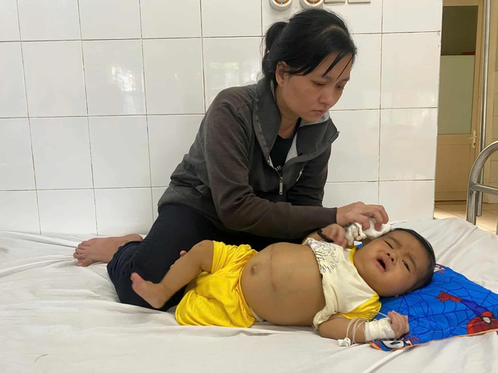 Ánh mắt cầu cứu của bé trai 7 tháng tuổi bụng to bất thường vì bệnh hiểm nghèo- Ảnh 1. Ánh mắt cầu cứu của bé trai 7 tháng tuổi bụng to bất thường vì bệnh hiểm nghèo- Ảnh 1.