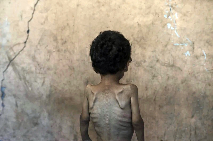 1/3 người dân ở Gaza không có gì ăn trong nhiều ngày, hàng chục người đã chết đói- Ảnh 1.