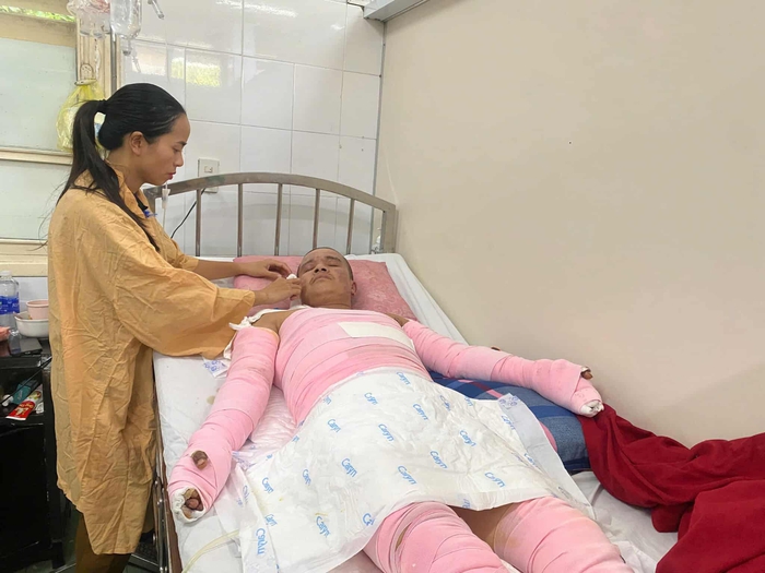 Xót xa hoàn cảnh người đàn ông bỏng nặng khi đi làm thuê kiếm tiền chạy chữa cho vợ - Ảnh 3.