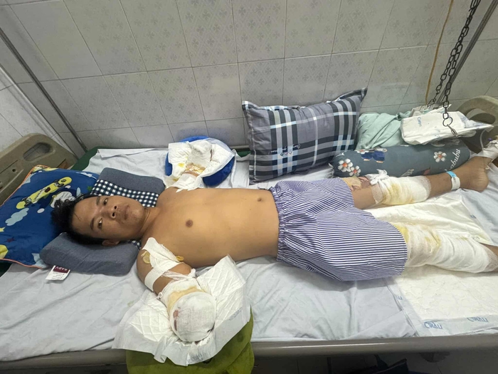 Lời cầu cứu của người đàn ông bị cắt bỏ cả 2 tay vì điện giật khi đang làm thuê- Ảnh 5.