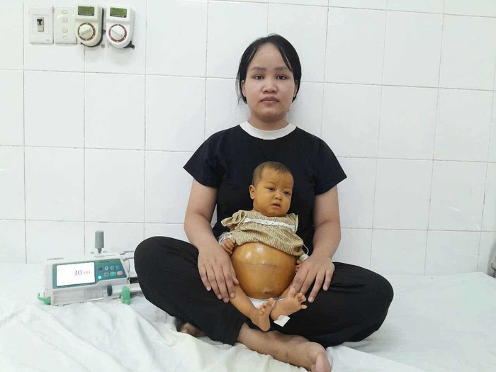 Ánh mắt cầu cứu của bé gái 6 tháng tuổi có bụng chực "nổ tung" - Ảnh 5.