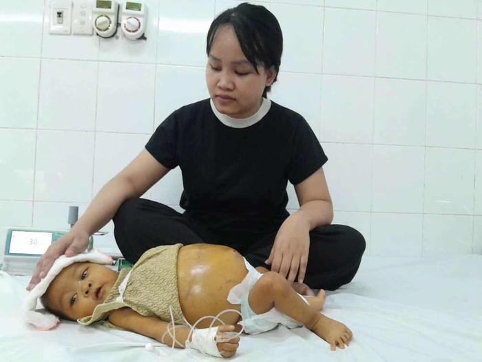 Ánh mắt cầu cứu của bé gái 6 tháng tuổi có bụng chực "nổ tung" - Ảnh 3.