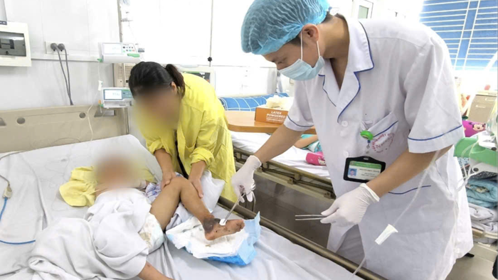 Bé trai 4 tuổi nguy kịch vì đắp thuốc nam chữa vết mèo cào- Ảnh 2. Bé trai 4 tuổi nguy kịch vì đắp thuốc nam chữa vết mèo cào- Ảnh 2.