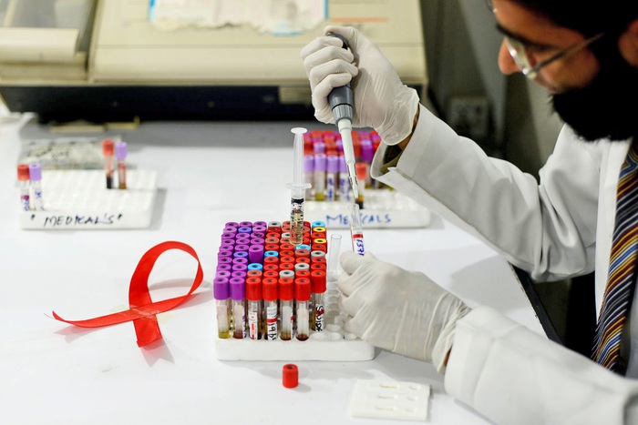 Cuộc chiến chống đại dịch HIV/AIDS vẫn còn gian nan - Ảnh 2.