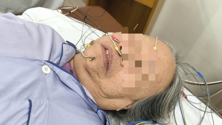 Trời rét đậm, nhiều người nhập viện vì đột ngột méo miệng, lệch mặt- Ảnh 1.