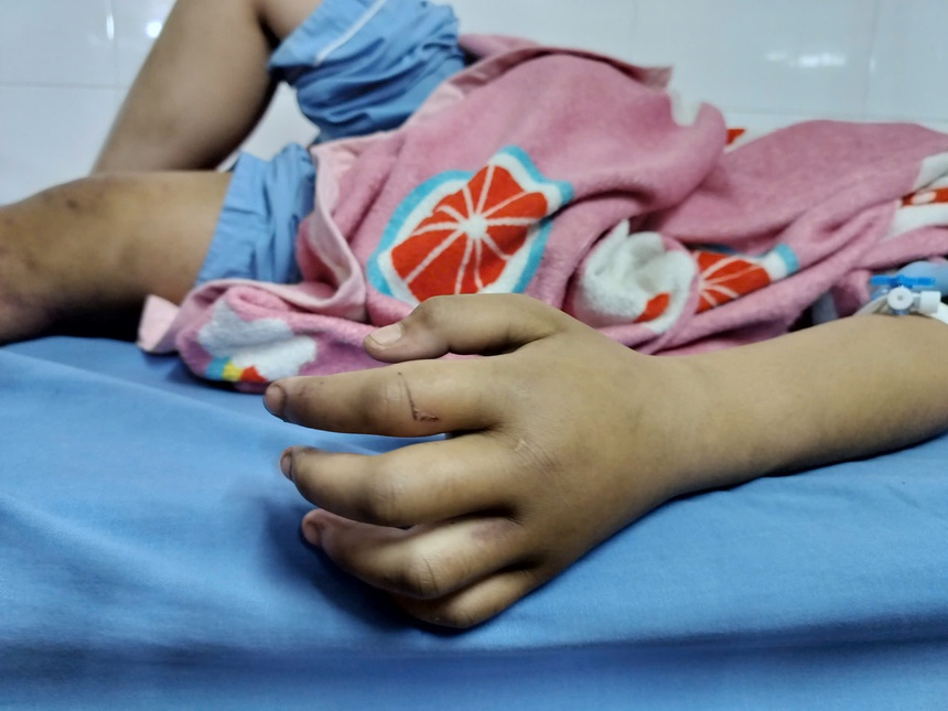 Vụ bé gái 13 tuổi bị bạo hành dã man ở Thái Nguyên: Vì sao tỷ lệ tổn thương cơ thể chỉ 5%?- Ảnh 1.