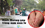 Hội chứng bàn chân ngập nước và nước ăn chân là 2 bệnh phổ biến trong mùa lũ