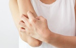 Những biện pháp ngăn ngừa nguy cơ nhiễm nấm da