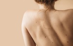 Làm tốt 4 điều này, bạn sẽ không phải lo về đốm đồi mồi xuất hiện trên da 