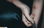 Đồng giải 3 hạng mục Ảnh cuộc thi “Tôi lên tiếng - Tôi hành động”: Cái nhìn trực diện vào nỗi đau bị bạo lực