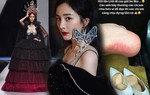 Chịu đau để mặc đẹp: Mỹ nhân Việt "vồ ếch" thấy thương, sao Trung bị biến dạng cả vành tai