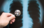 Ứng dụng X-Quang và CT-Scaner trong chẩn đoán bệnh phổi tắc nghẽn mãn tính (COPD)