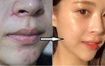 6 thói quen giúp da đẹp lên mỗi ngày, không cần tốn tiền mua mỹ phẩm