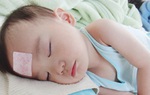 Tìm hiểu chung về thể nặng của bệnh sởi