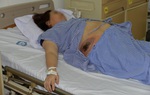 Đắp thuốc lá, nữ bệnh nhân phải cấp cứu vì nhiễm trùng