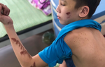 Hội Bảo vệ quyền trẻ em Việt Nam đề nghị Bắc Ninh nhanh chóng khởi tố hình sự vụ chủ tiệm bánh xèo đánh đập dã man trẻ em