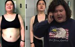Hút mỡ bất thành, "hotgirl trăm ký" Về nhà đi con tự thân giảm cân: Da chùng nhão thấy thương