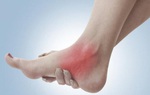 Hướng dẫn cách chữa bong gân đơn giản tại nhà