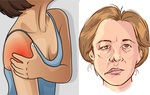 1001 nguyên nhân gây đột quỵ ít ai ngờ tới