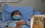 Dùng thớt gỗ 10 năm không thay, 2 cha con bị ung thư gan. Bác sĩ nói gì?