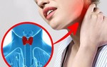 Tự kiểm tra bệnh tuyến giáp nhờ 1 cốc nước, làm ngay kẻo nhỡ ung thư để lâu khó chữa