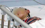 Bé 3 tuổi suýt mất mạng vì uống nhầm chai "độc dược"