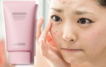 Chẳng may bị dị ứng kem chống nắng, những điều các nàng nên thực hiện ngay