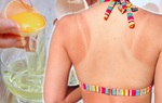 Áp dụng 5 cách chăm sóc da bị cháy nắng đơn giản giúp da lên tông nhanh chóng