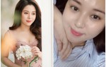 Căn bệnh khiến nữ MC của VTVCab phải chi 200 triệu mỗi tháng để chữa nguy hiểm thế nào?