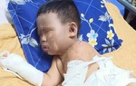 Không cầm được nước mắt trước cảnh bé trai bỏng khắp người vì bị ném bom xăng đêm sinh nhật