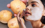 4 công thức chăm sóc da mặt mùa hè giúp bạn không lo da nổi mụn hay sạm đi