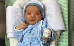Em bé bị mẹ bỏ rơi ở hố ga: Mắt và tai không bị tổn thương nghiêm trọng