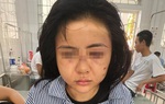 Hội LHPN tỉnh Yên Bái nói gì về vụ cô gái bị gã đàn ông xăm trổ đánh đập suốt 2 tiếng?