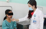 Mặt sưng phù, lở loét do dùng sản phẩm lột trắng da mua trên mạng