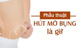 Hút mỡ bụng và những sai lầm biến chứng thường gặp dẫn đến tử vong