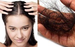 Rụng tóc: Nguyên nhân và cách ngăn ngừa rụng tóc