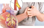 Co thắt động mạch vành vào lúc nửa đêm hoặc buổi sáng