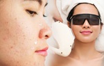 Đầu tư tiền triệu đi trị mụn mà chẳng hiệu quả, hãy nghe giải đáp của chuyên gia