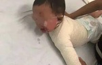 Con trai bị bỏng nước sôi, mẹ tưới thêm một thứ được bác sĩ ca ngợi hết lời