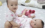 Hơn 90 y bác sĩ sẽ tham gia ca đại phẫu tách bé gái song sinh dính liền